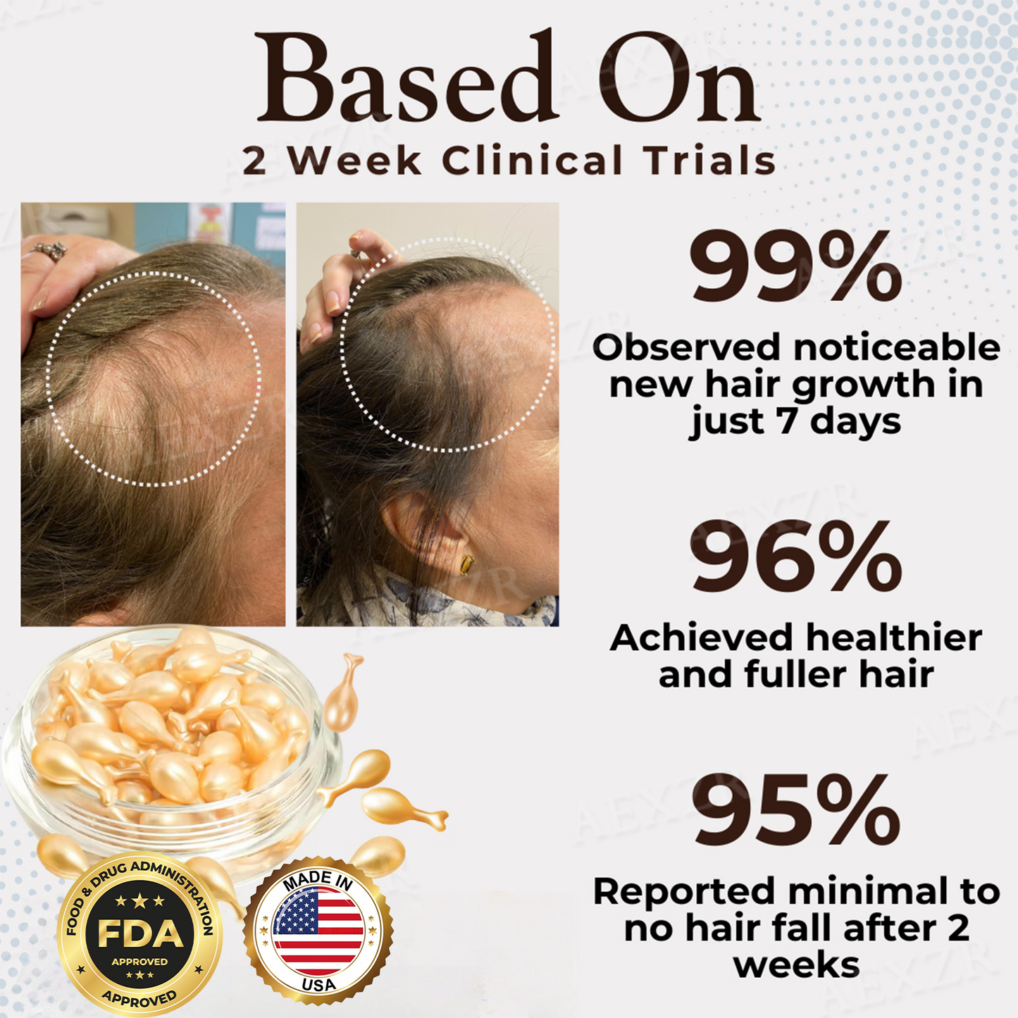 Hair Regrowth Capsules