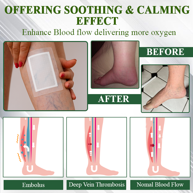 MicroDrain Edema Relief Microneedle Patch