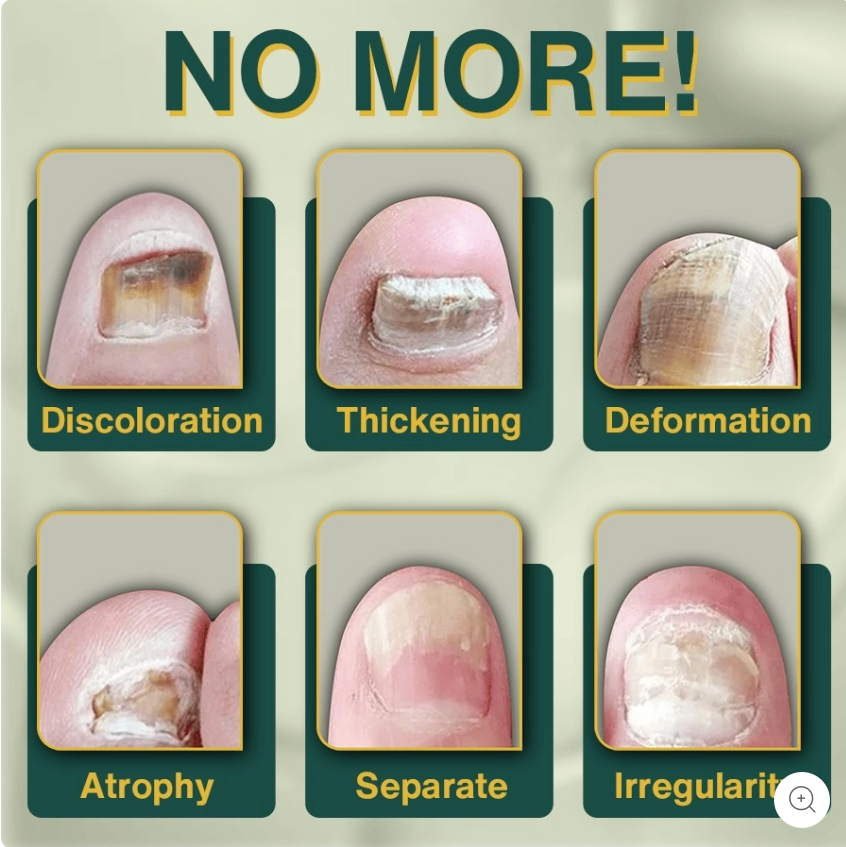 7 Days Nail Fungus Treatment