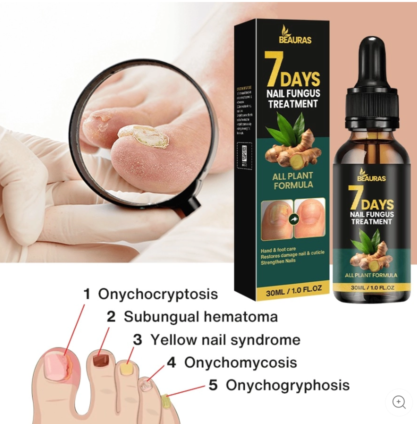 7 Days Nail Fungus Treatment