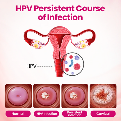 EvaHeal® IntiDefend Anti-HPV Interferon Gel✅